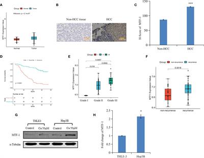 Metal-Regulatory Transcription Factor-1 Targeted by miR-148a-3p Is Implicated in Human Hepatocellular Carcinoma Progression